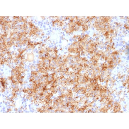 Immunohistochemistry - Anti-Chromogranin A Antibody - BSA and Azide free (A251393) - Antibodies.com