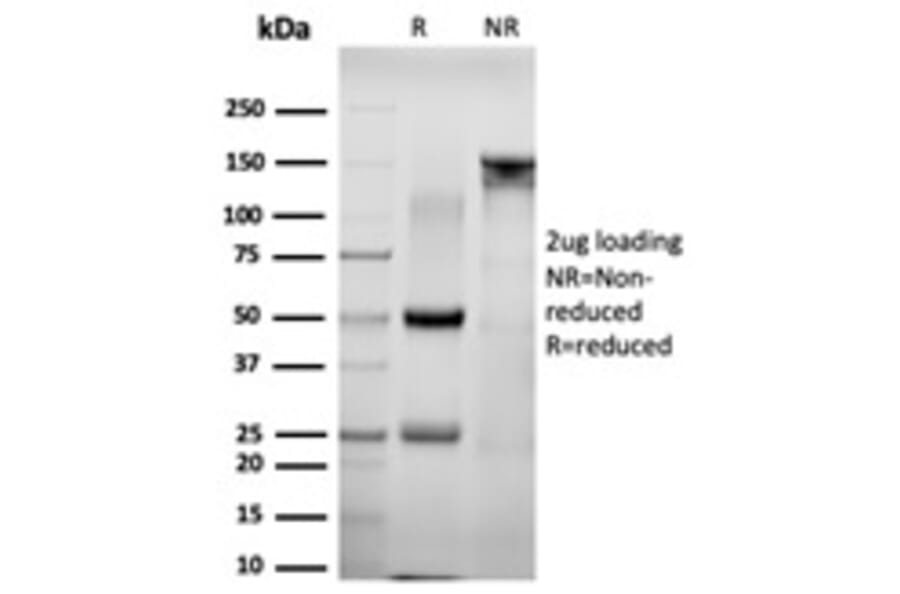SDS-PAGE - Anti-NACC1 Antibody [PCRP-NACC1-1A8] - BSA and Azide free (A251396) - Antibodies.com