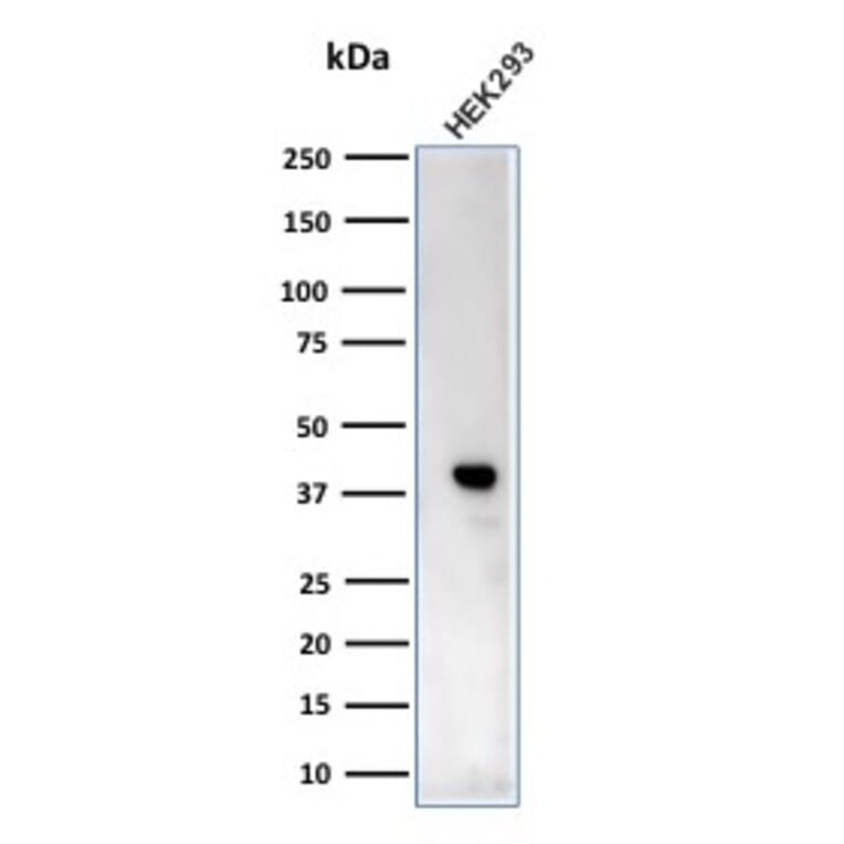 Western Blot - Anti-Creatine Kinase BB Antibody [CPTC-CKB-2] - BSA and Azide free (A251400) - Antibodies.com