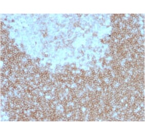 Immunohistochemistry - Anti-BAFF-R Antibody [BAFFR/1557] - BSA and Azide free (A251400) - Antibodies.com