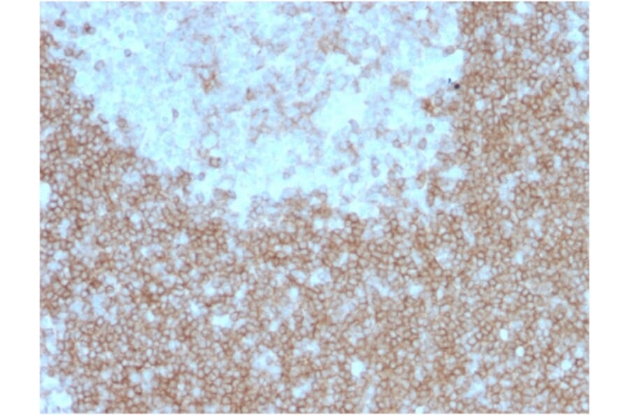Immunohistochemistry - Anti-BAFF-R Antibody [BAFFR/1557] - BSA and Azide free (A251400) - Antibodies.com