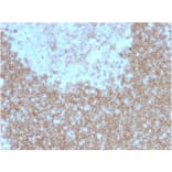 Immunohistochemistry - Anti-BAFF-R Antibody [BAFFR/1557] - BSA and Azide free (A251400) - Antibodies.com