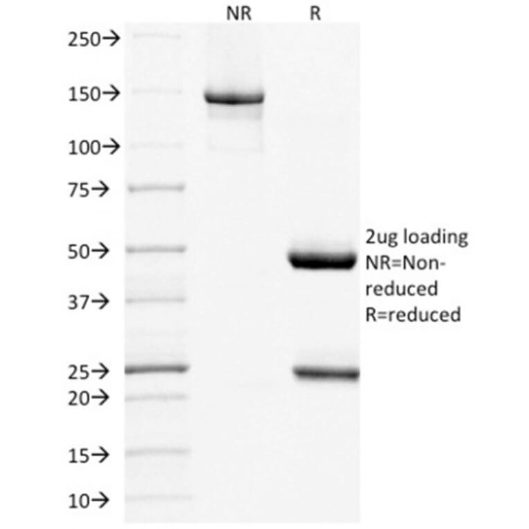 SDS-PAGE - Anti-BAFF-R Antibody [BAFFR/1557] - BSA and Azide free (A251401) - Antibodies.com