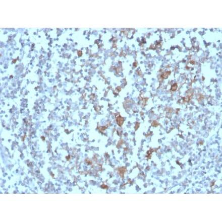 Immunohistochemistry - Anti-BAFF-R Antibody [BAFFR/1558] - BSA and Azide free (A251401) - Antibodies.com