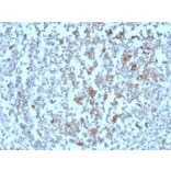 Immunohistochemistry - Anti-BAFF-R Antibody [BAFFR/1558] - BSA and Azide free (A251401) - Antibodies.com