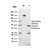 SDS-PAGE - Anti-BAFF-R Antibody [BAFFR/1558] - BSA and Azide free (A251402) - Antibodies.com