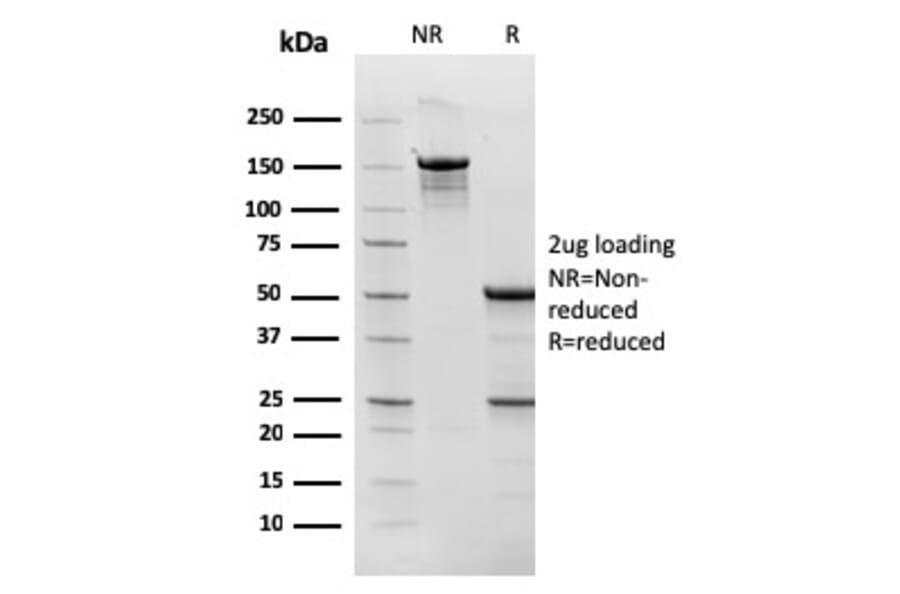 SDS-PAGE - Anti-TOP1MT Antibody [TOP1MT/568] - BSA and Azide free (A251405) - Antibodies.com