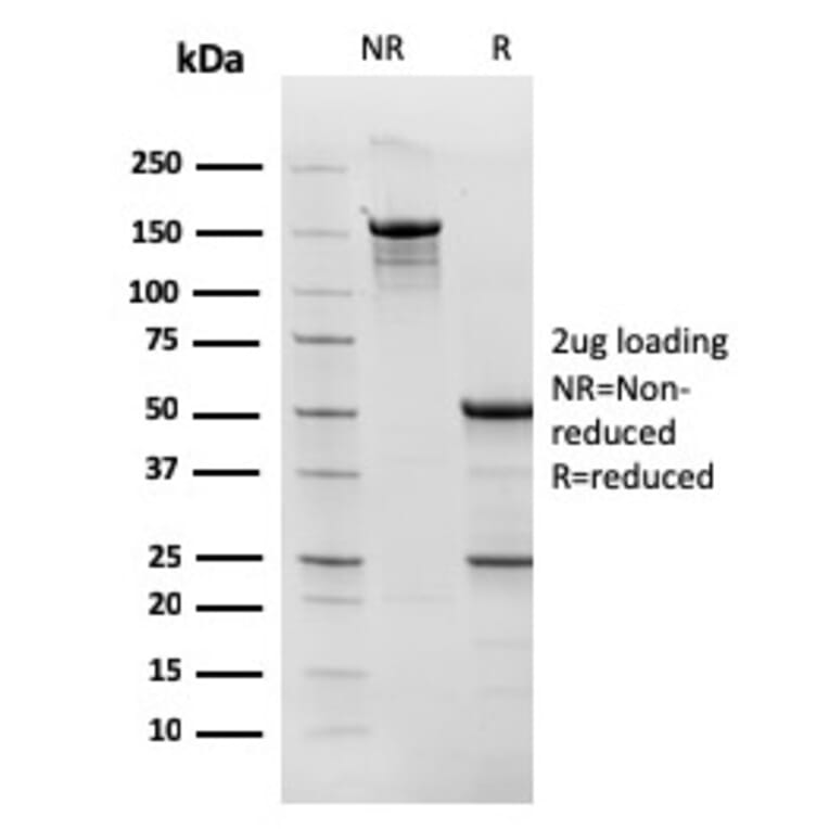 SDS-PAGE - Anti-TOP1MT Antibody [TOP1MT/568] - BSA and Azide free (A251405) - Antibodies.com