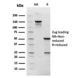 SDS-PAGE - Anti-TOP1MT Antibody [TOP1MT/568] - BSA and Azide free (A251405) - Antibodies.com