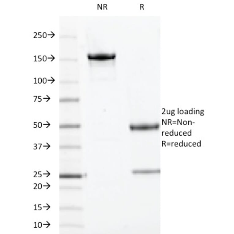 SDS-PAGE - Anti-TOP1MT Antibody [TOP1MT/613] - BSA and Azide free (A251406) - Antibodies.com