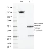 SDS-PAGE - Anti-TOP1MT Antibody [TOP1MT/613] - BSA and Azide free (A251406) - Antibodies.com