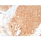 Immunohistochemistry - Anti-TOP1MT Antibody [TOP1MT/2883R] - BSA and Azide free (A251406) - Antibodies.com