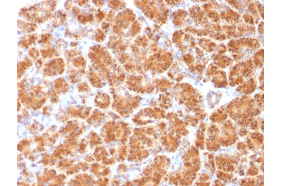 Immunohistochemistry - Anti-Clathrin Light Chain Antibody [CLC/1421] - BSA and Azide free (A251407) - Antibodies.com