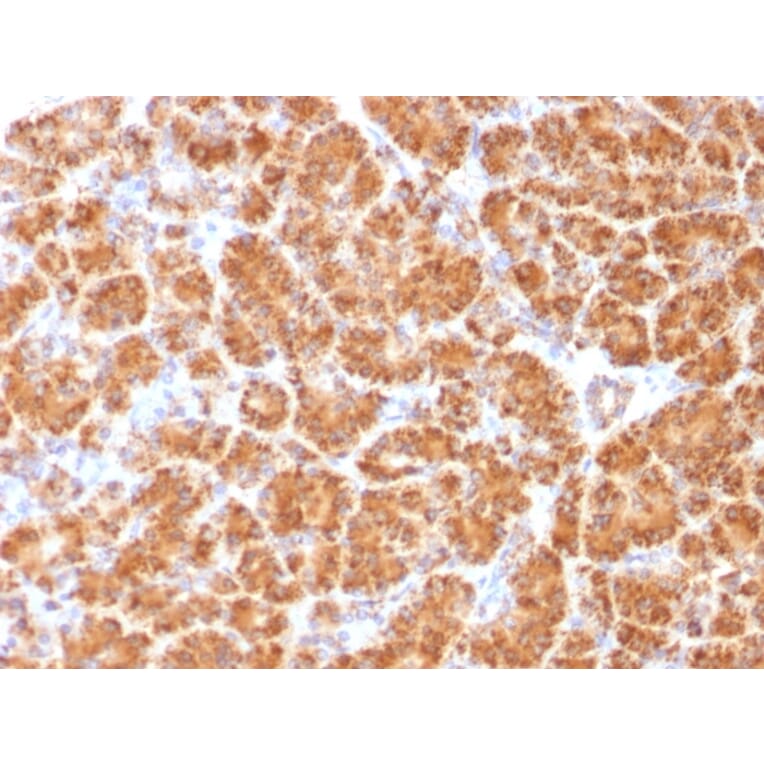 Immunohistochemistry - Anti-Clathrin Light Chain Antibody [CLC/1421] - BSA and Azide free (A251407) - Antibodies.com
