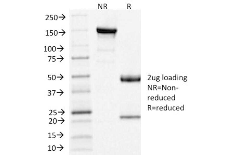 SDS-PAGE - Anti-Clathrin Light Chain Antibody [CLC/1421] - BSA and Azide free (A251408) - Antibodies.com