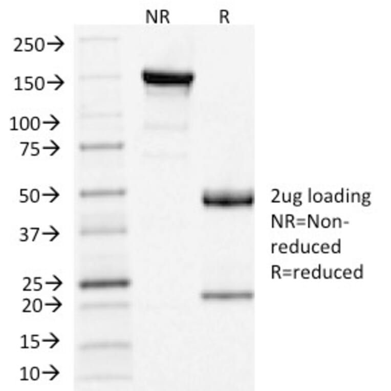 SDS-PAGE - Anti-Clathrin Light Chain Antibody [CLC/1421] - BSA and Azide free (A251408) - Antibodies.com