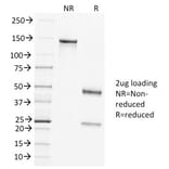 SDS-PAGE - Anti-Clathrin Heavy Chain Antibody [CLTC/1431] - BSA and Azide free (A251409) - Antibodies.com