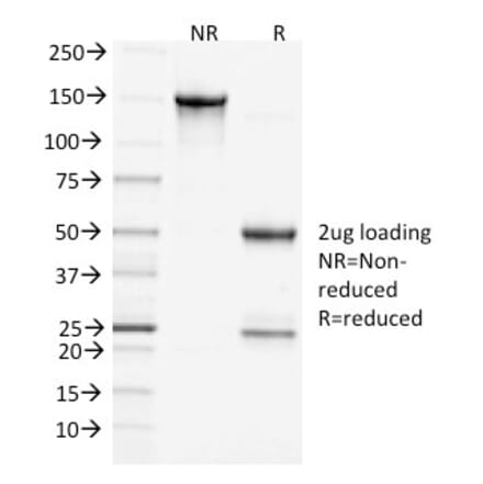 SDS-PAGE - Anti-Clathrin Heavy Chain Antibody [CHC/1432] - BSA and Azide free (A251411) - Antibodies.com