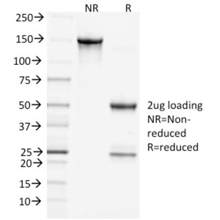 SDS-PAGE - Anti-Clathrin Heavy Chain Antibody [CHC/1432] - BSA and Azide free (A251411) - Antibodies.com
