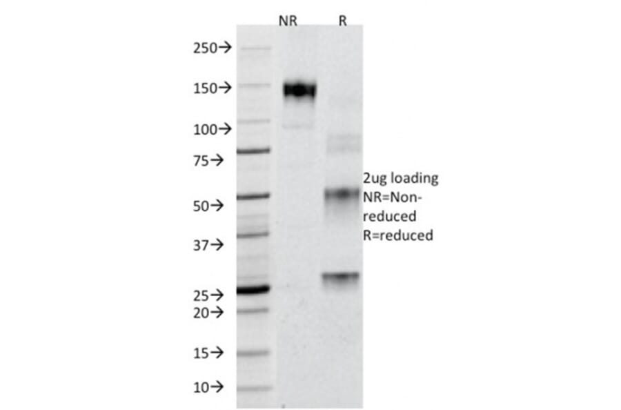 SDS-PAGE - Anti-Adipophilin Antibody [ADFP/1365] - BSA and Azide free (A251414) - Antibodies.com