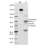 SDS-PAGE - Anti-Adipophilin Antibody [ADFP/1365] - BSA and Azide free (A251414) - Antibodies.com