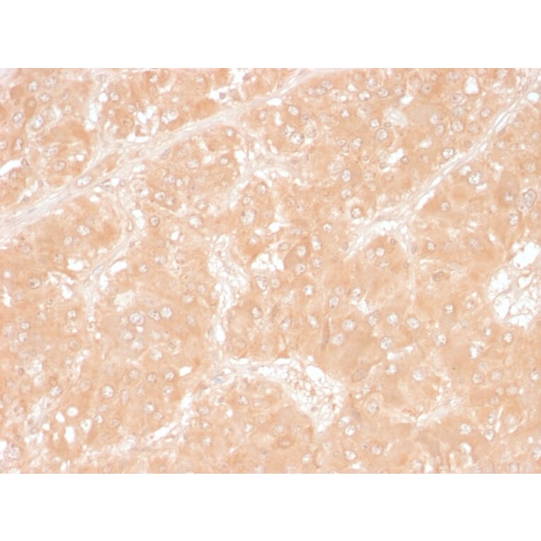 Immunohistochemistry - Anti-Adipophilin Antibody [ADFP/1366] - BSA and Azide free (A251415) - Antibodies.com
