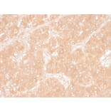 Immunohistochemistry - Anti-Adipophilin Antibody [ADFP/1366] - BSA and Azide free (A251415) - Antibodies.com
