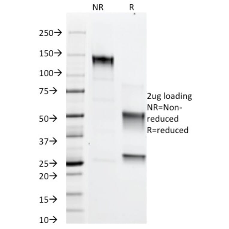 SDS-PAGE - Anti-Adipophilin Antibody [ADFP/1366] - BSA and Azide free (A251415) - Antibodies.com