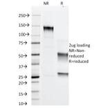 SDS-PAGE - Anti-Adipophilin Antibody [ADFP/1366] - BSA and Azide free (A251415) - Antibodies.com