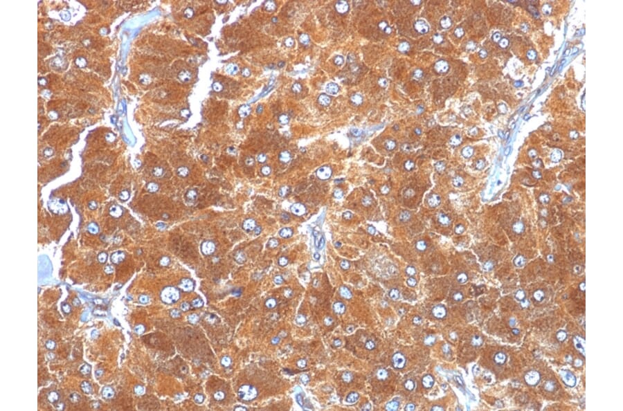 Immunohistochemistry - Anti-Adipophilin Antibody [ADFP/1494] - BSA and Azide free (A251416) - Antibodies.com