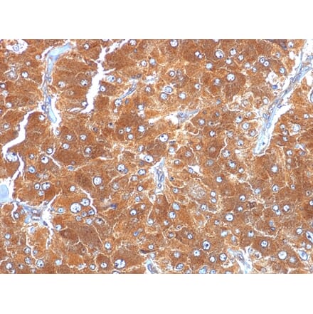 Immunohistochemistry - Anti-Adipophilin Antibody [ADFP/1494] - BSA and Azide free (A251416) - Antibodies.com