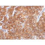 Immunohistochemistry - Anti-Adipophilin Antibody [ADFP/1494] - BSA and Azide free (A251416) - Antibodies.com