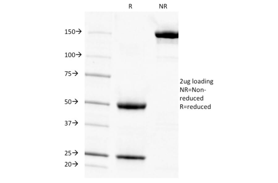 SDS-PAGE - Anti-Adipophilin Antibody [ADFP/1494] - BSA and Azide free (A251417) - Antibodies.com