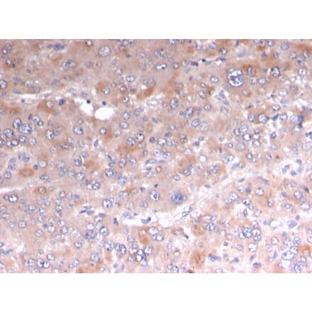 Immunohistochemistry - Anti-Adipophilin Antibody [rADFP/1493] - BSA and Azide free (A251417) - Antibodies.com