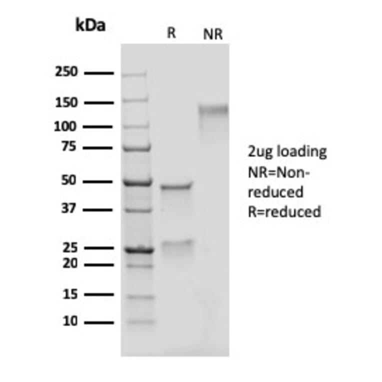 SDS-PAGE - Anti-Adipophilin Antibody [rADFP/1493] - BSA and Azide free (A251418) - Antibodies.com