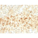 Immunohistochemistry - Anti-Adipophilin Antibody [ADFP/2755R] - BSA and Azide free (A251418) - Antibodies.com