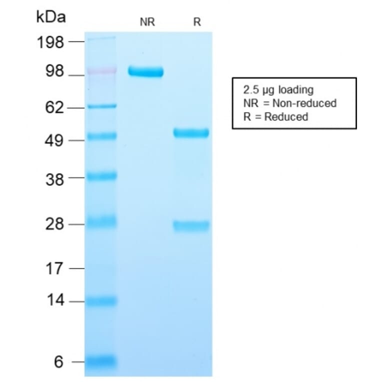 SDS-PAGE - Anti-Adipophilin Antibody [ADFP/2755R] - BSA and Azide free (A251419) - Antibodies.com