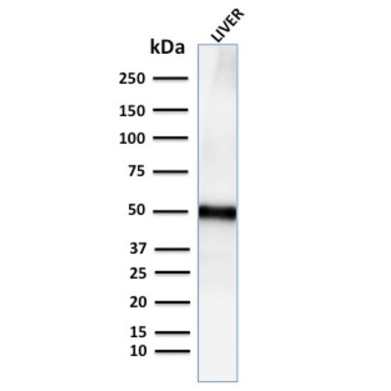 Western Blot - Anti-Adipophilin Antibody [ADFP/2755R] - BSA and Azide free (A251419) - Antibodies.com