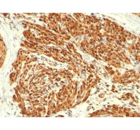 Immunohistochemistry - Anti-Calponin 1 Antibody [CALP] - BSA and Azide free (A251420) - Antibodies.com