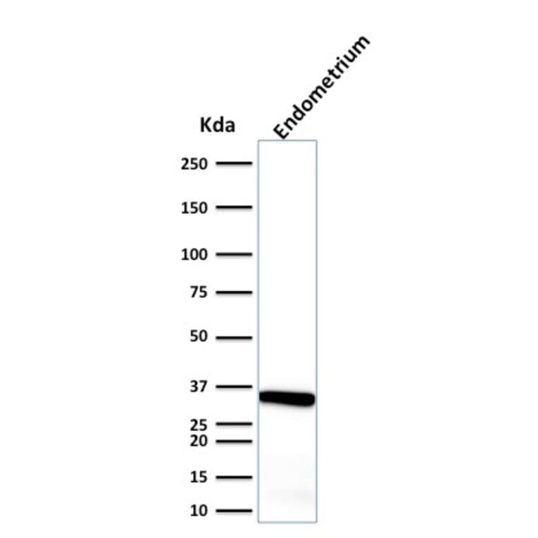 Western Blot - Anti-Calponin 1 Antibody [CALP] - BSA and Azide free (A251420) - Antibodies.com