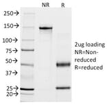 SDS-PAGE - Anti-Calponin 1 Antibody [CALP] - BSA and Azide free (A251420) - Antibodies.com