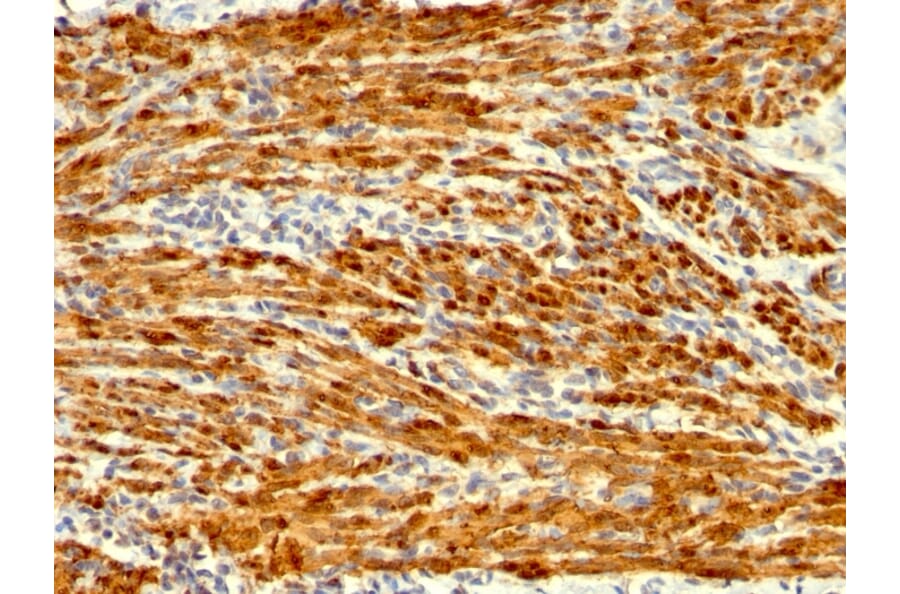 Immunohistochemistry - Anti-Calponin 1 Antibody [SPM169] - BSA and Azide free (A251421) - Antibodies.com