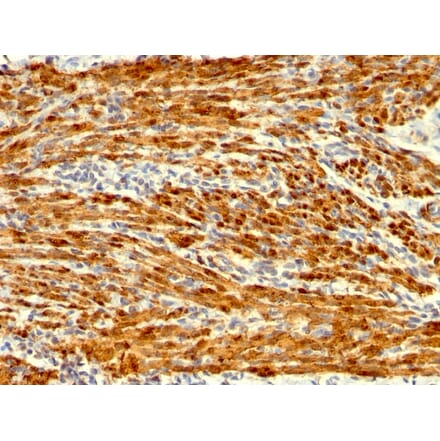 Immunohistochemistry - Anti-Calponin 1 Antibody [SPM169] - BSA and Azide free (A251421) - Antibodies.com