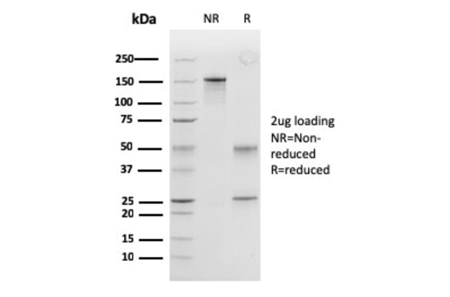 SDS-PAGE - Anti-Calponin 1 Antibody [SPM169] - BSA and Azide free (A251421) - Antibodies.com
