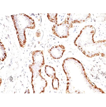 Immunohistochemistry - Anti-Calponin 1 Antibody [CNN1/832] - BSA and Azide free (A251422) - Antibodies.com