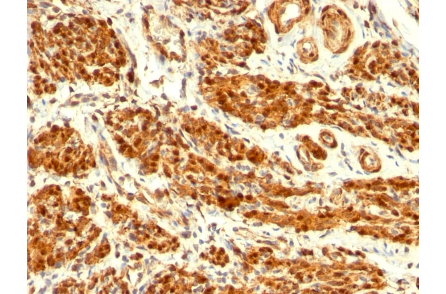 Immunohistochemistry - Anti-Calponin 1 Antibody [CNN1/832] - BSA and Azide free (A251422) - Antibodies.com