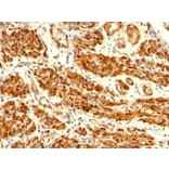 Immunohistochemistry - Anti-Calponin 1 Antibody [CNN1/832] - BSA and Azide free (A251422) - Antibodies.com