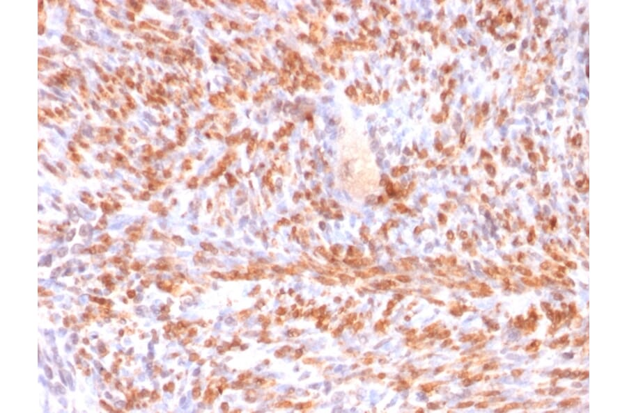 Immunohistochemistry - Anti-Calponin 1 Antibody [rCNN1/832] - BSA and Azide free (A251423) - Antibodies.com