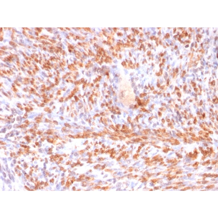 Immunohistochemistry - Anti-Calponin 1 Antibody [rCNN1/832] - BSA and Azide free (A251423) - Antibodies.com