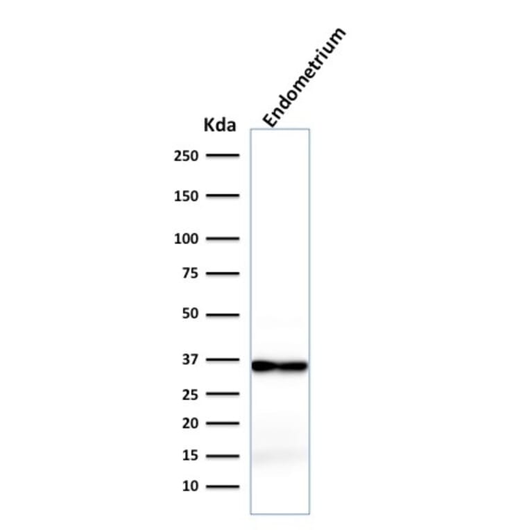Western Blot - Anti-Calponin 1 Antibody [rCNN1/832] - BSA and Azide free (A251423) - Antibodies.com